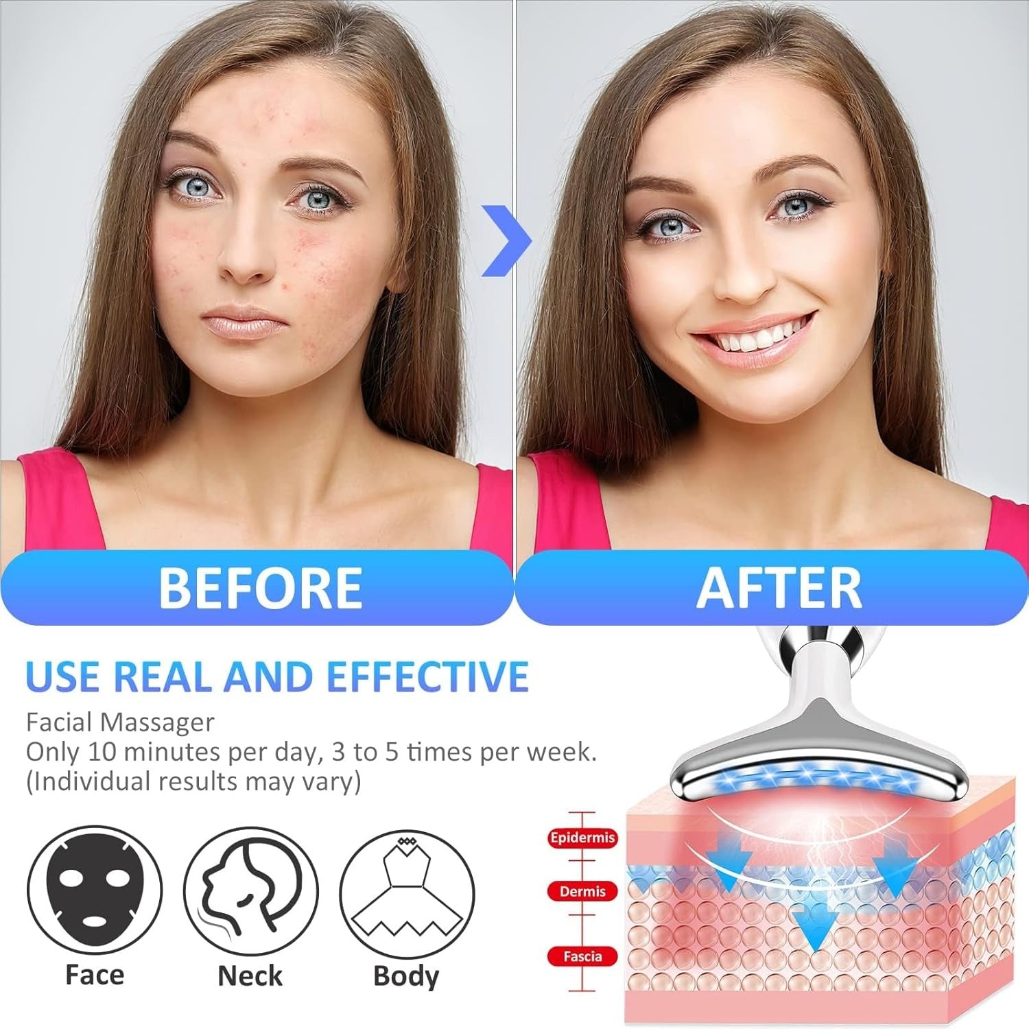 EMS Facial Massager